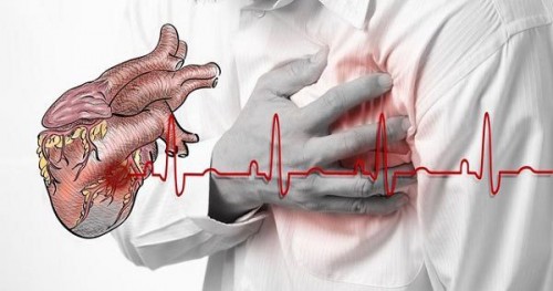 10 giây để tự cứu mình sống sót qua con đau tim khi chỉ ở một mình