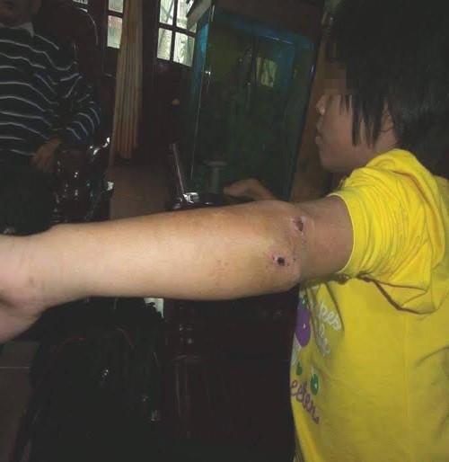 CA Hưng Yên thông tin vụ bé gái thương tích bị nhốt trong chùa