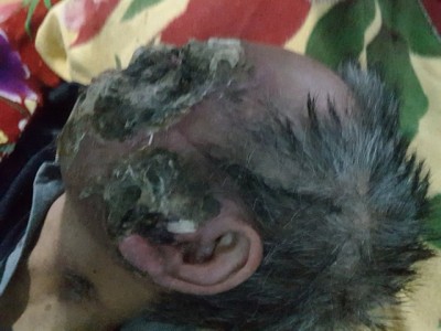 Người đàn ông mang căn bệnh lạ, hoàn cảnh tận cùng nỗi đau