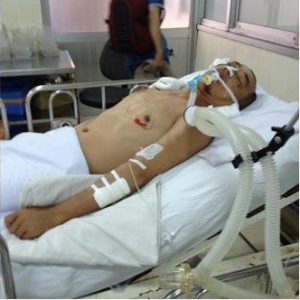 ĐĐ.Thích Thanh Quang, trụ trì chùa Phổ Minh bị tai nạn cần sự giúp sức