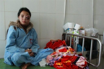 Thương tâm cô bé dân tộc H'mông bị căn bệnh quái ác