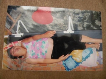 Bệnh nhân cô đơn rất cần sự giúp đỡ