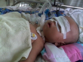 Thương tâm cháu bé hôn mê hơn 2 tháng chưa tỉnh