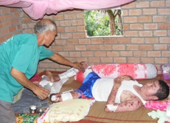 Không tiền đưa con đi viện, cha già tự cắt thịt thối để cứu con