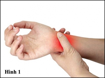 Cách chữa nghẹt mũi, chảy mũi, hết ho không cần thuốc