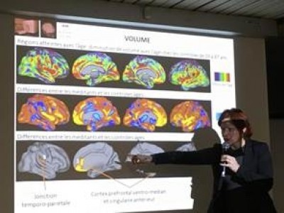 Phép thiền định có thể ngăn ngừa bệnh kém trí nhớ Alzheimer