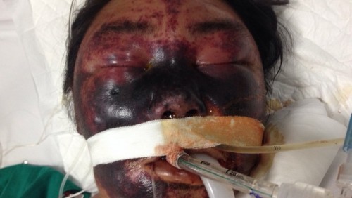 Hay làm và ăn tiết canh sẽ bị quả báo như thế nào