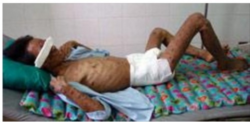 Sống, hãy nghĩ đến người khác