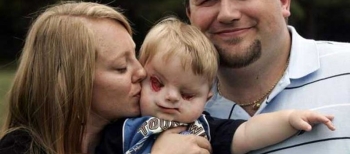 Không phá thai dù biết con sinh ra sẽ tật nguyền