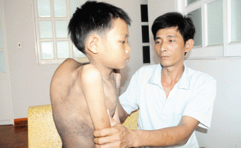 Xin giúp cháu Thương được phẫu thuật lưng